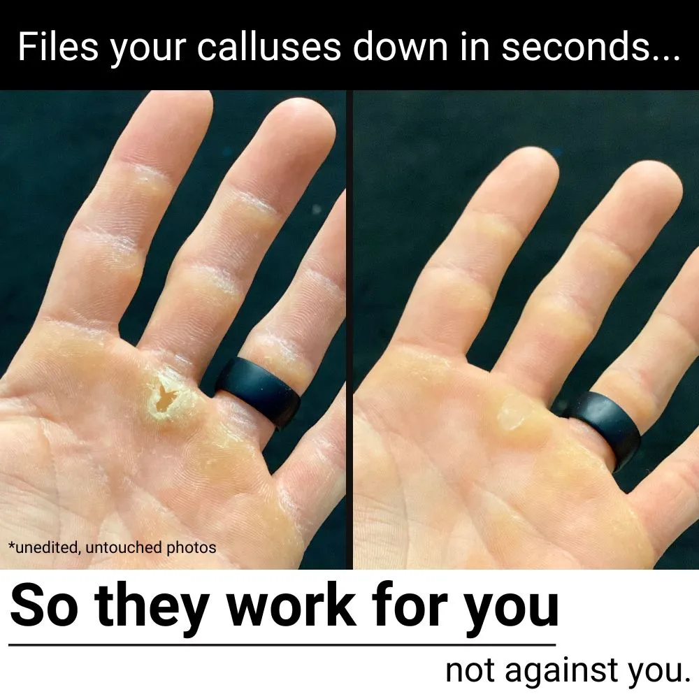 SandBar 4" Quickie Callus File Kit